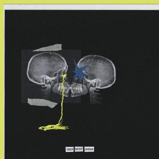 Nikra - Über beide Ohren (yellow-trans white LP)