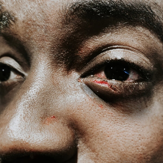 Guvna B - Village Is On Fire (col. LP)